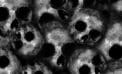 The Black Death and its aftermath The Black Death and its aftermath