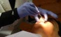 The wisdom (or lack of) in prescribing opiates after tooth removal The wisdom (or lack of) in prescribing opiates after tooth removal