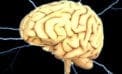 Brain scan studies shed light on ADHD Brain scan studies shed light on ADHD