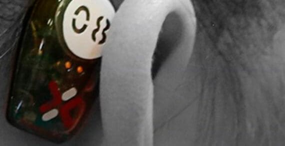 Wearable tech helps people manage multiple sclerosis Wearable tech helps people manage multiple sclerosis