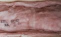 Installing insulation can be hazardous to your health Installing insulation can be hazardous to your health
